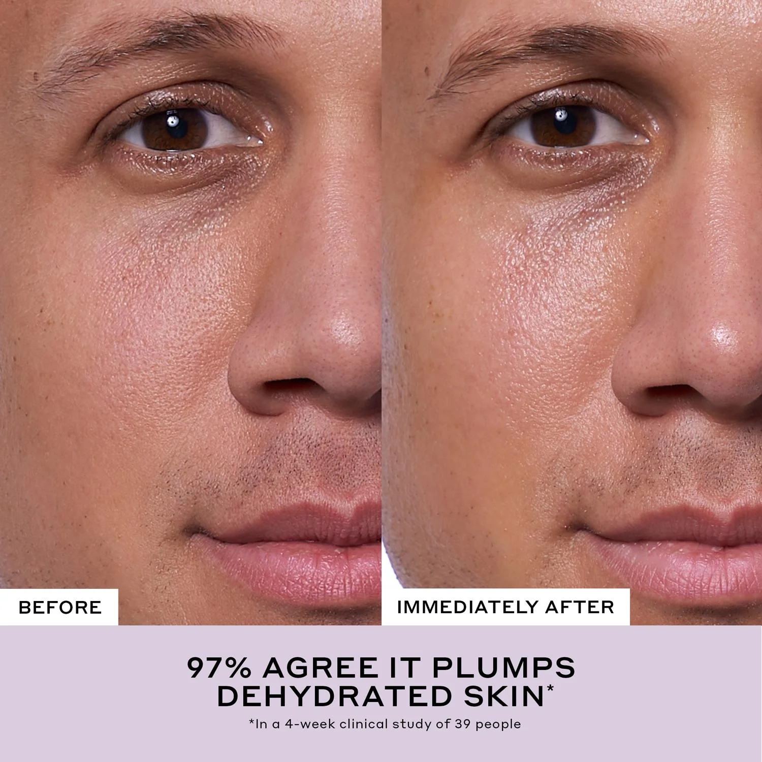 Après Skin Rich Rescue Barrier Moisturizer with Ceramides - Image 5