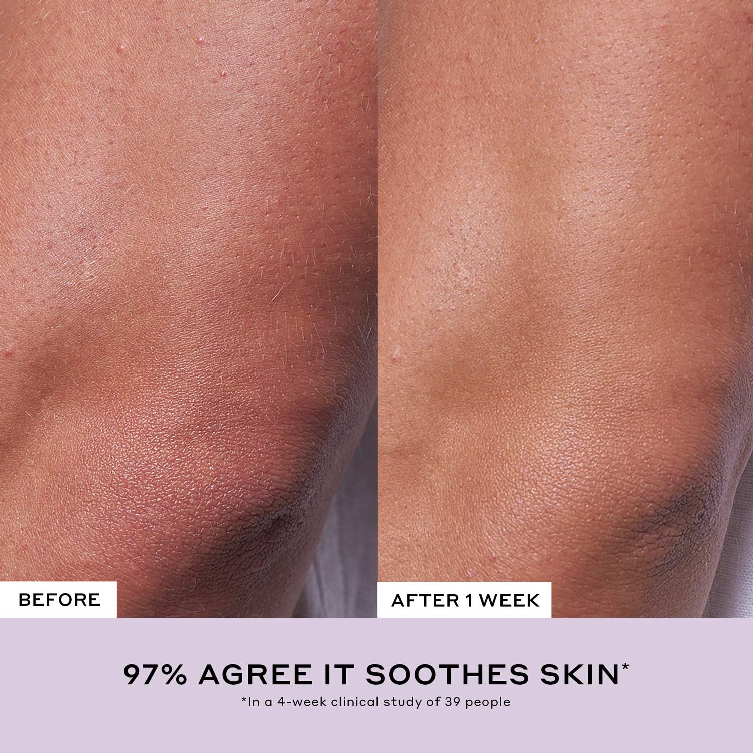 Après Skin Rich Rescue Barrier Moisturizer with Ceramides - Image 6