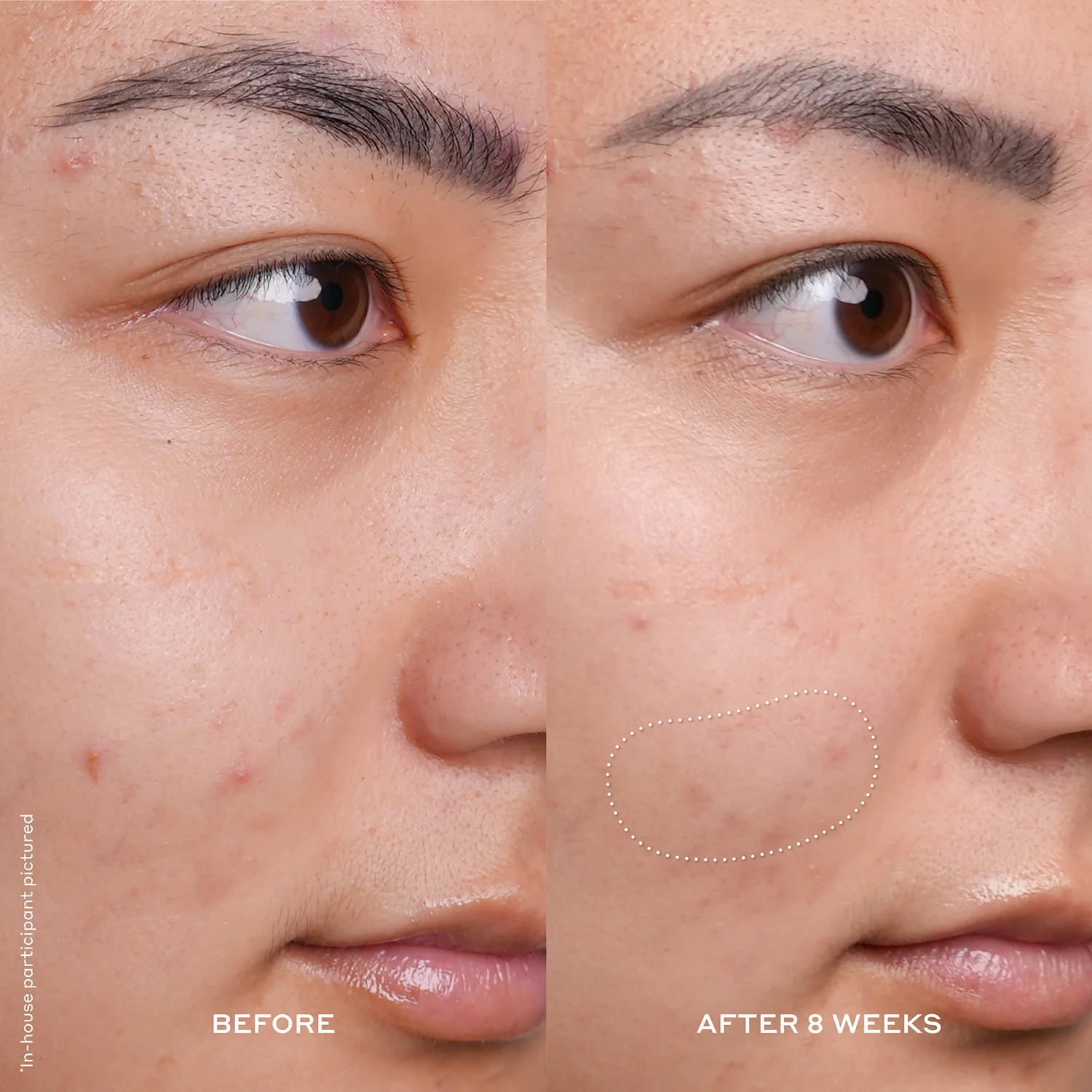 Banana Bright 15% Vitamin C Dark Spot Serum - Image 4