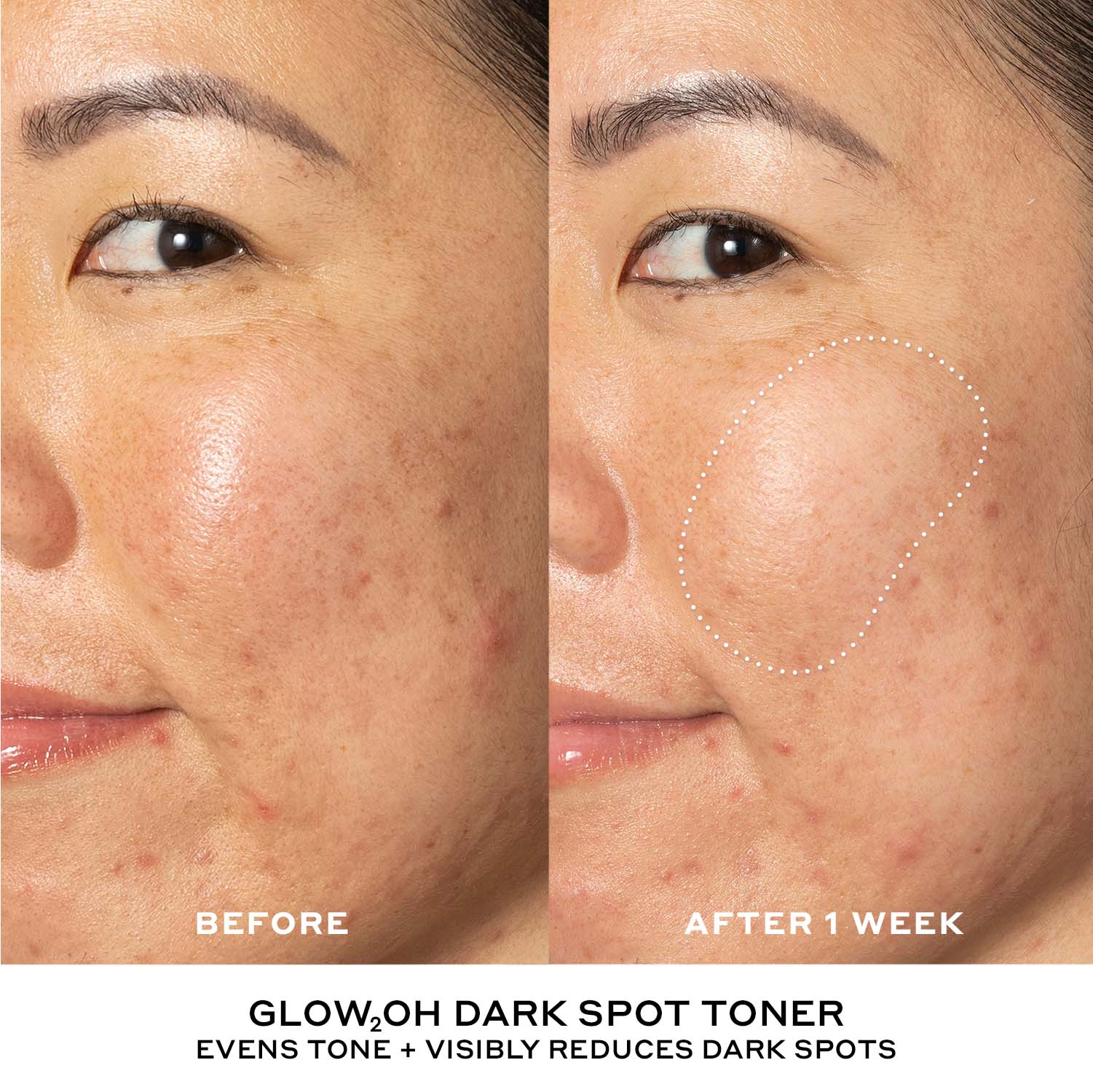 Best + Brightest Mini Skincare Starter Set - Image 5