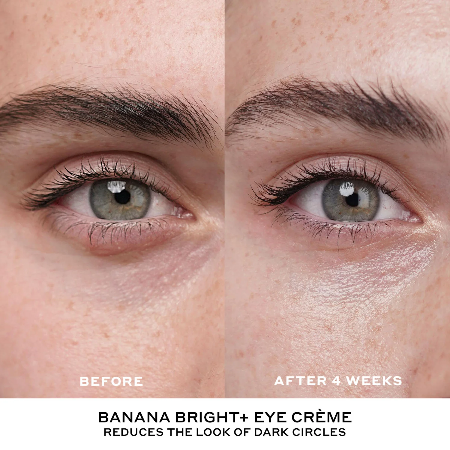 Best + Brightest Mini Skincare Starter Set - Image 8