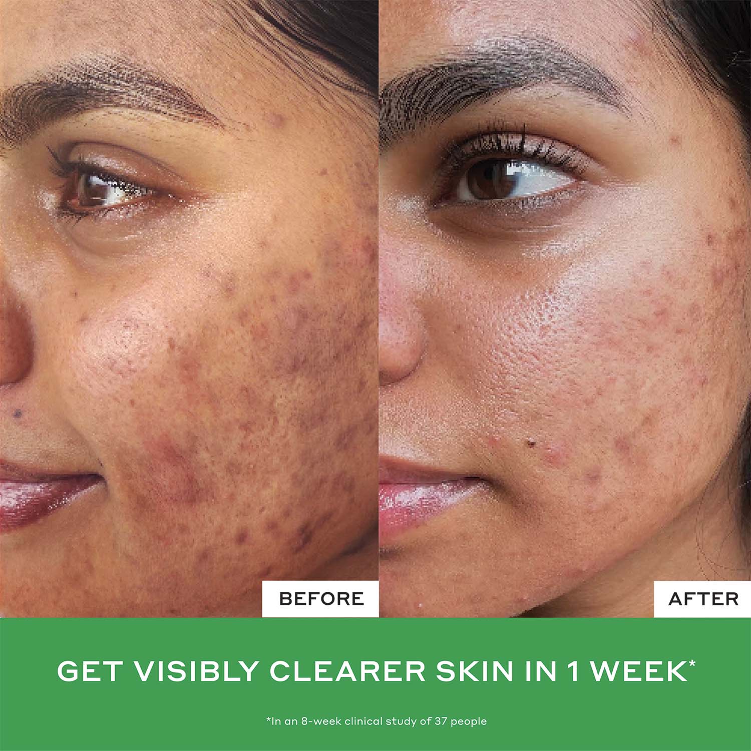 Best In Class Skincare Bestseller Set - Image 5