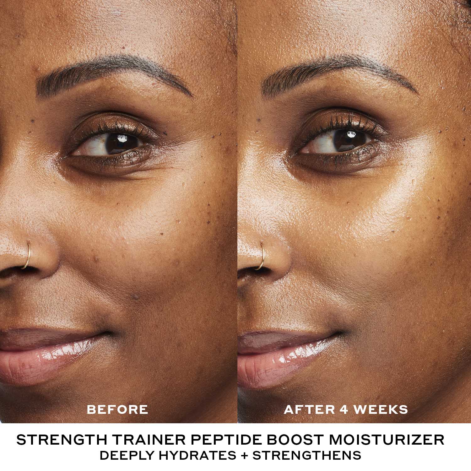 Best In Class Skincare Bestseller Set - Image 7