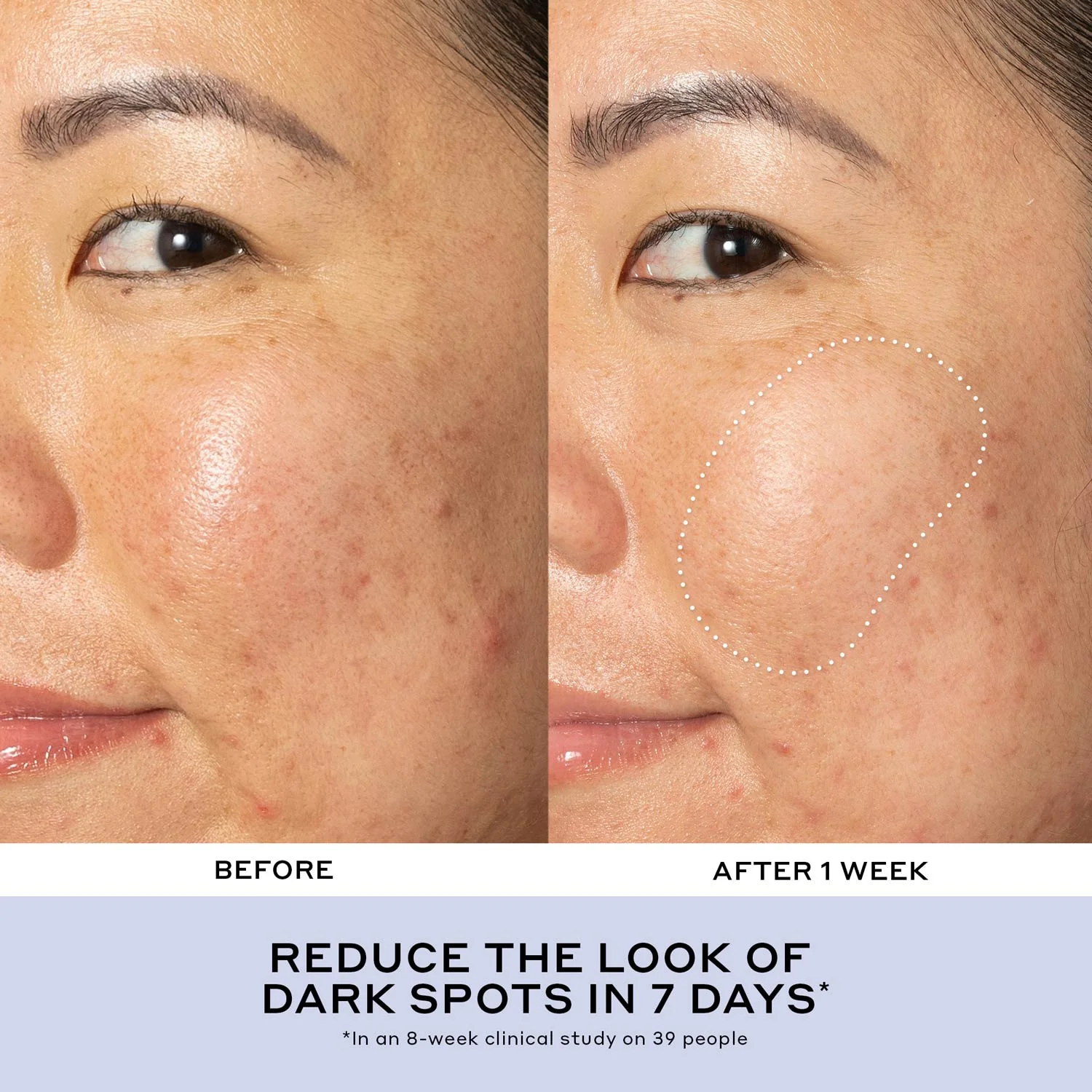 Best of Ole Skincare Essential Set - Image 10