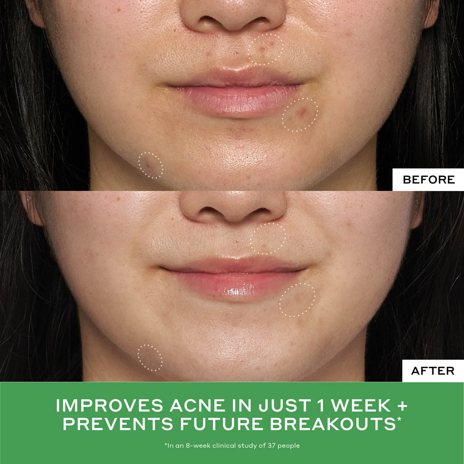 Detox Drops 2% Salicylic Acid Toner - Image 3