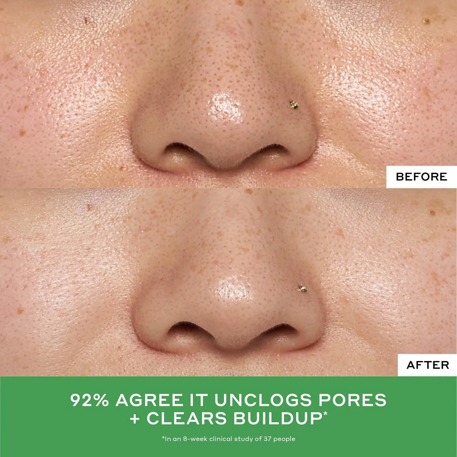 Detox Drops 2% Salicylic Acid Toner - Image 4