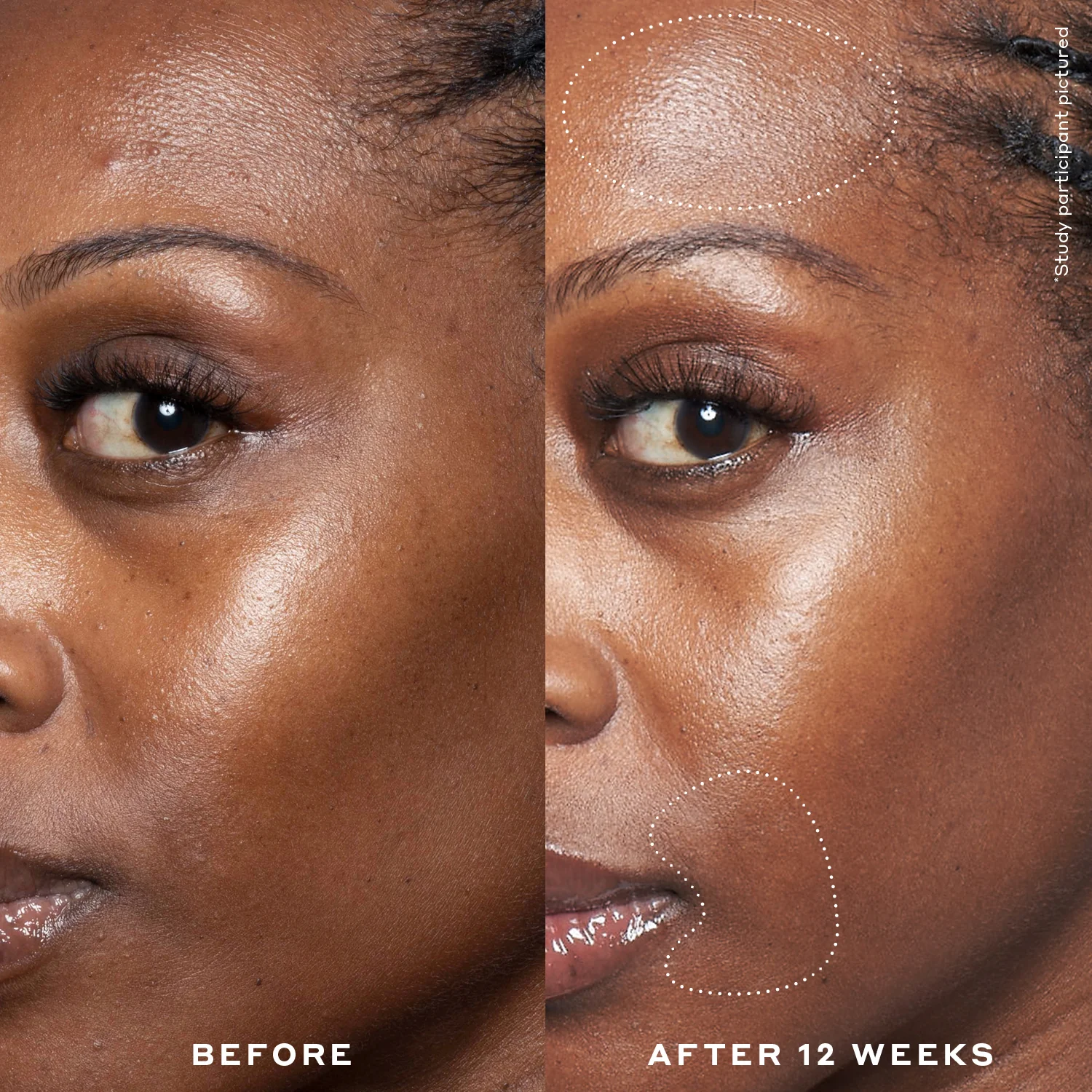 Double Rewind 0.3% Pro-Grade Retinol Serum - Image 4