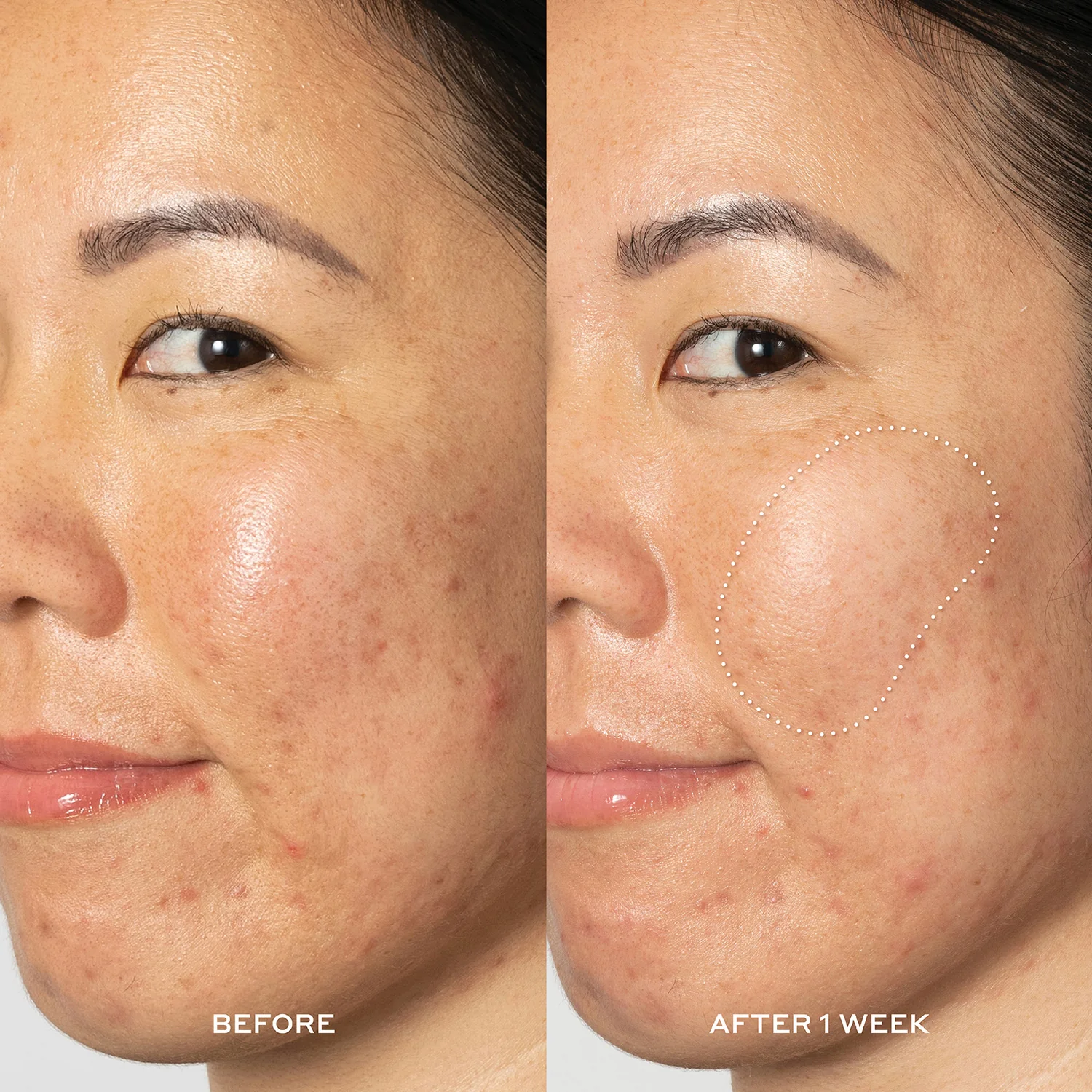 Glow2OH Exfoliating Dark Spot Toner with Glycolic & Lactic Acid - Image 4