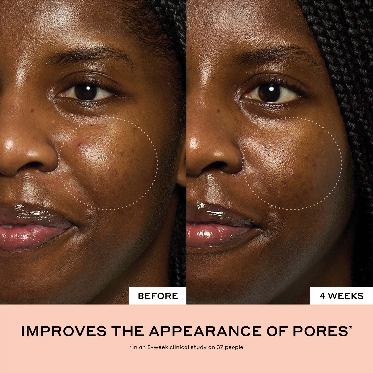 Peach Glaze Glow Niacinamide Serum with Vitamin C - Image 15